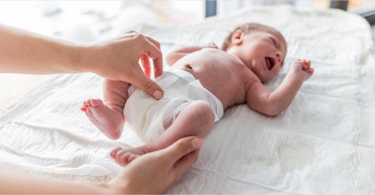 Diaper Rash in Newborns: Symptoms, Causes and Treatments