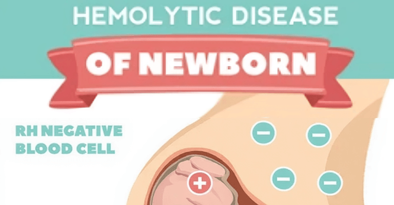 What is Haemolytic Disease in Newborns? A Complete Parent’s Guide