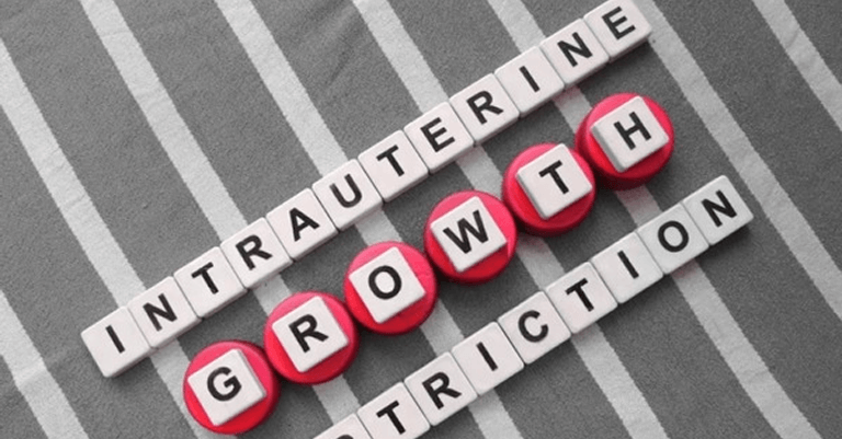 Intrauterine Growth Retardation: Causes, Symptoms, and Treatment Explained